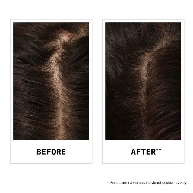 Nioxin Hair Fall Defense Shampoo